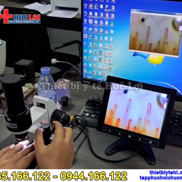 Máy soi mạch máu độ phân giải 1200x