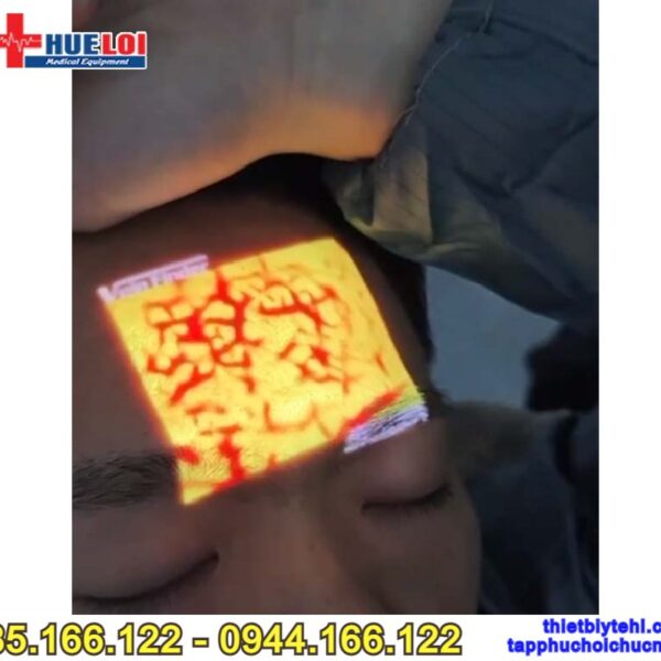 Máy soi vein QV-600