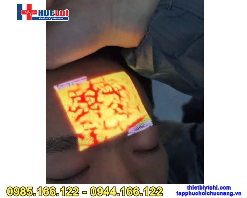 Máy soi vein QV-600