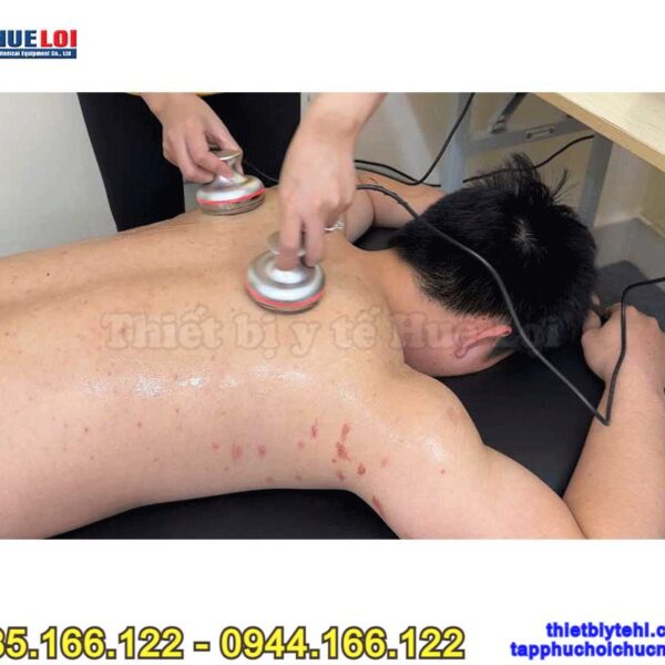 Máy châm cứu không kim - Máy điện châm kèm giác hút