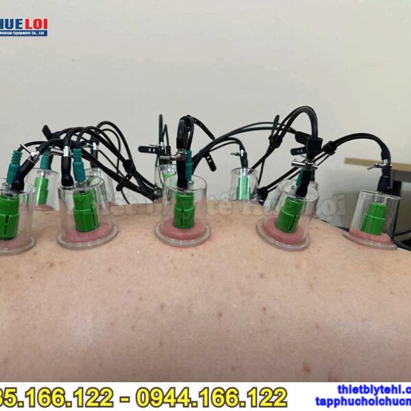 Máy châm cứu không kim - Máy điện châm kèm giác hút