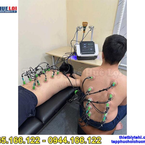 Máy châm cứu không kim - Máy điện châm kèm giác hút