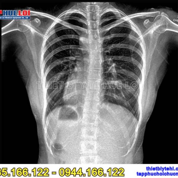 Máy X-Quang cố định giá tốt