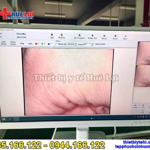 Máy soi cổ tử cung giá rẻ 302